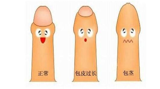 包莖
